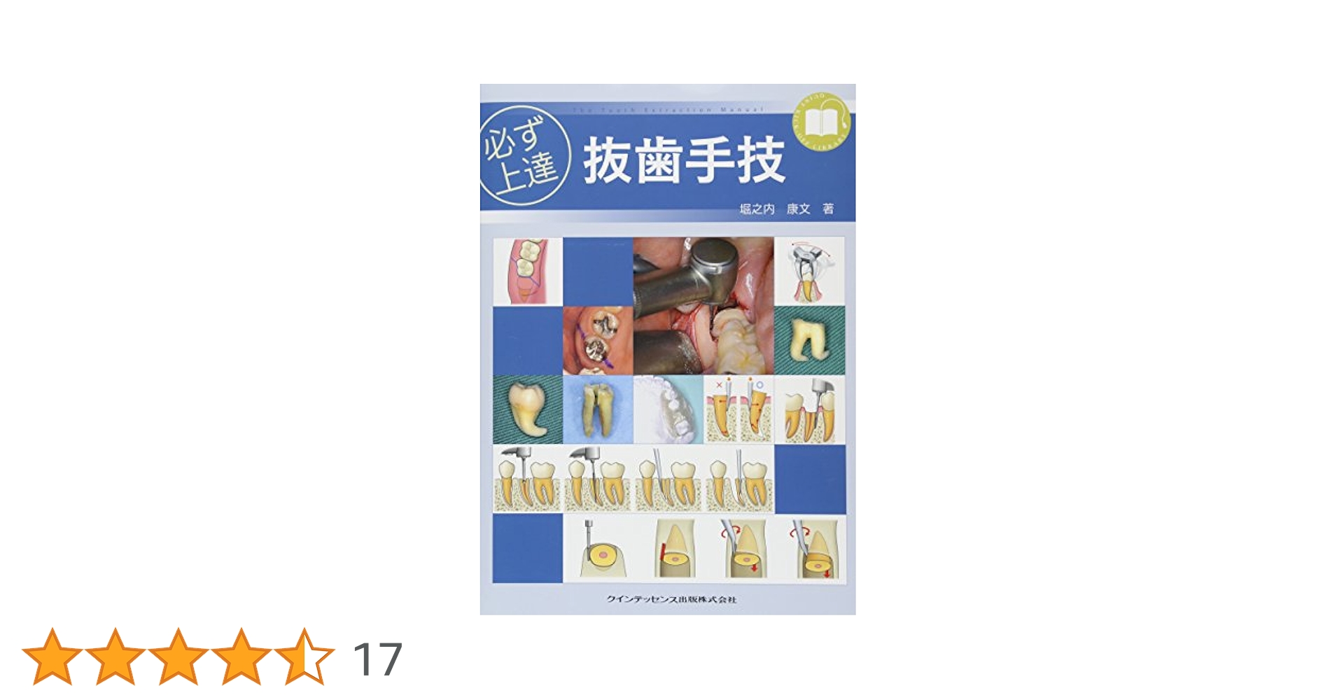 必ず上達抜歯手技 必ず上達 抜歯手技 | 堀之内 康文 |本 | 通販 | Amazon